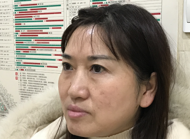 不开刀按摩去眼袋你有什么疑问?我来说下!753 不开刀按摩去眼袋你有什么疑问?我来说下!753