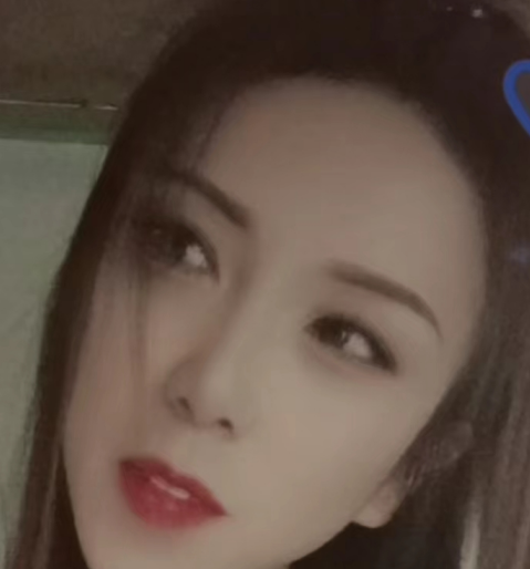 去眼袋手术