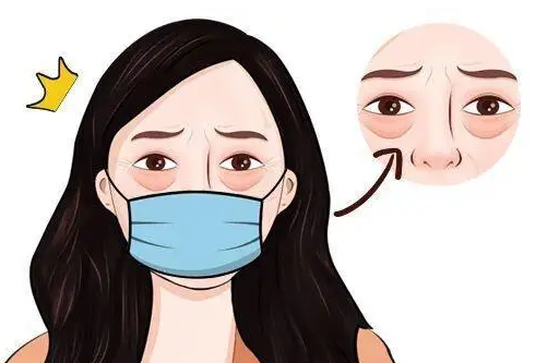 去眼袋手术