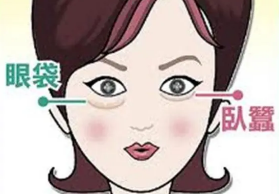 去眼袋手术