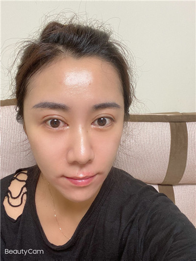 去眼袋手术