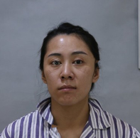 去眼袋手术