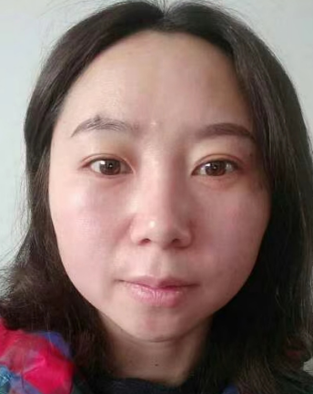 去眼袋手术