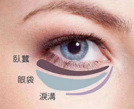 去眼袋手术