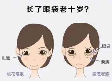 去眼袋手术