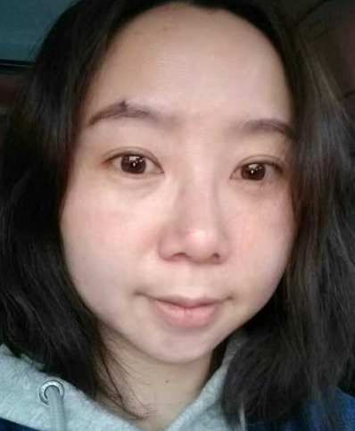 去眼袋手术