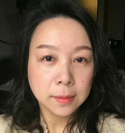 去眼袋手术