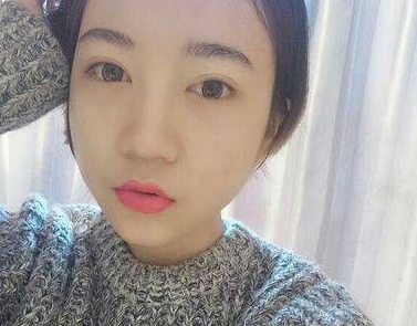 去眼袋手术