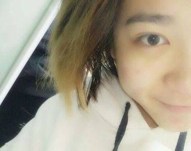 去眼袋手术