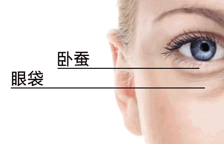 去眼袋手术