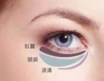 去眼袋手术