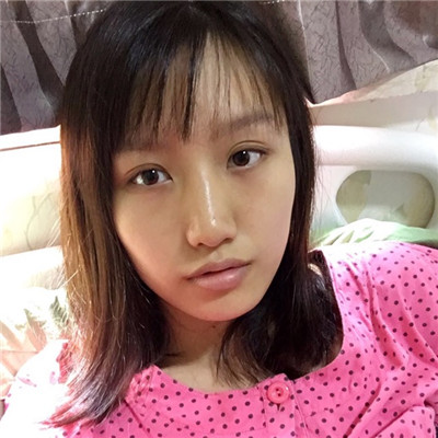 自体脂肪填充