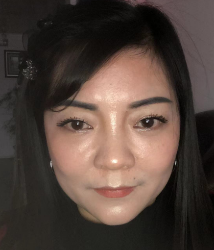 去眼袋手术