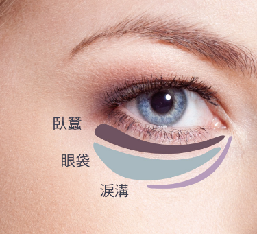 去眼袋手术