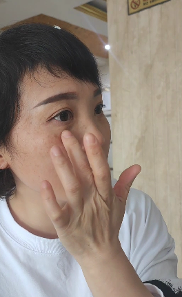 去眼袋手术