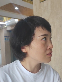 去眼袋手术