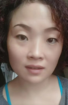 去眼袋手术
