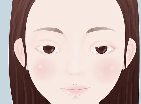 双眼皮手术