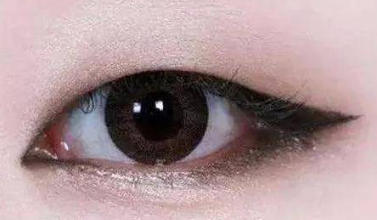 双眼皮手术