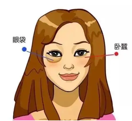 去眼袋手术
