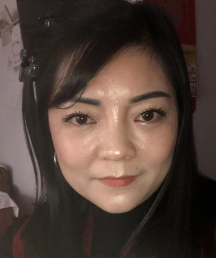 去眼袋手术