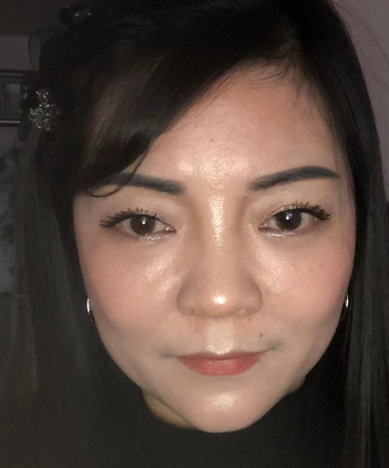 去眼袋手术