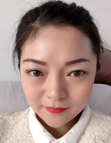 去眼袋手术