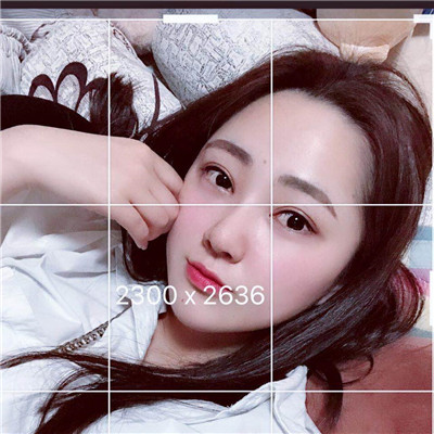 双眼皮手术