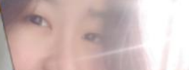 双眼皮手术