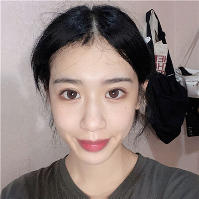 双眼皮