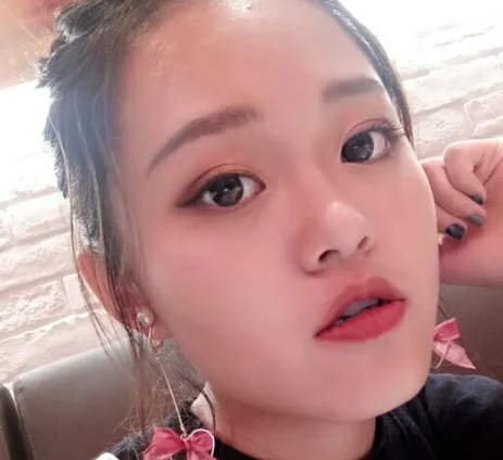 双眼皮手术