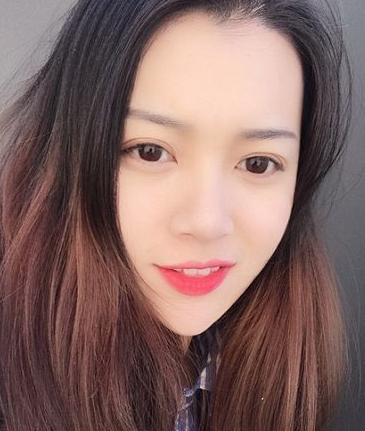 双眼皮手术