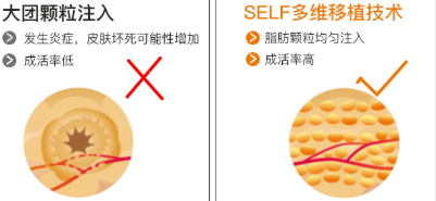 丰泪沟