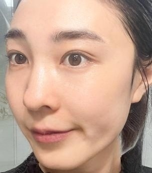 眼袋