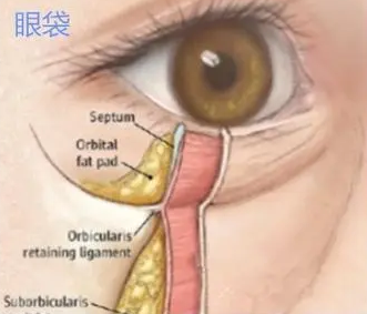 眼袋