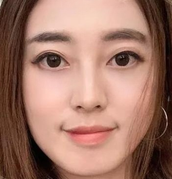 眼袋