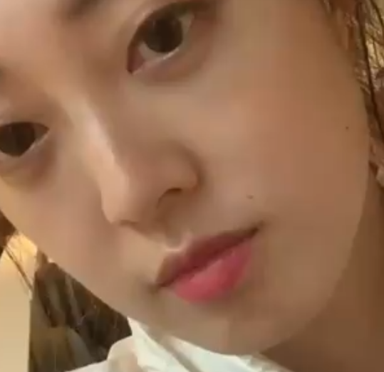 眼袋