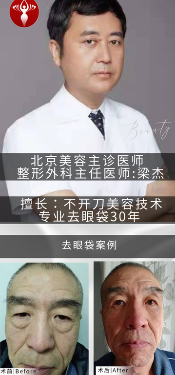去眼袋手术
