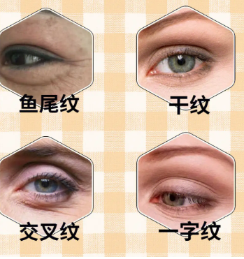 去眼袋手术