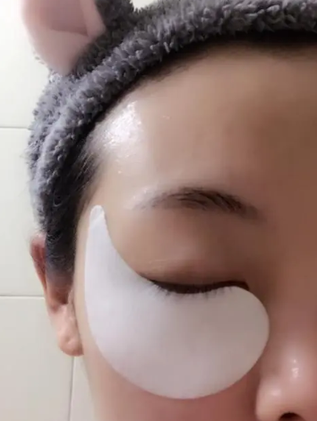 去眼袋手术
