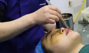 去眼袋手术