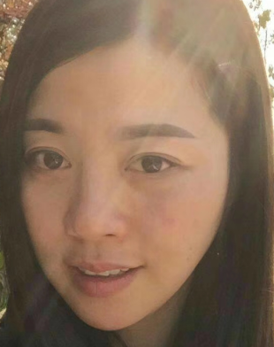 去眼袋手术