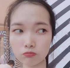 去眼袋手术