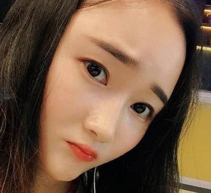 自体脂肪胶