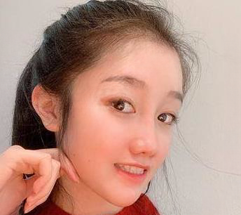 自体脂肪胶