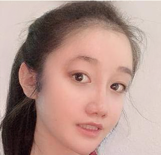 自体脂肪胶
