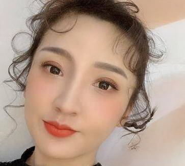 自体脂肪胶