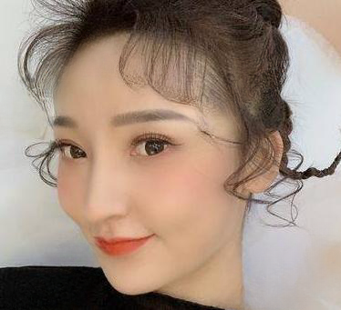 自体脂肪胶