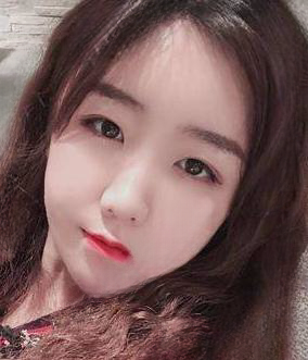 自体脂肪胶