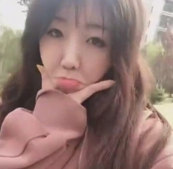 自体脂肪胶